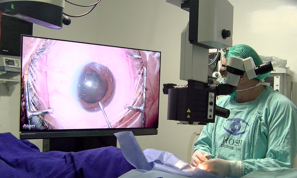 Cirurgia oftalmológica 3D é exclusividade no Hospital Oftalmológico Santa Beatriz.