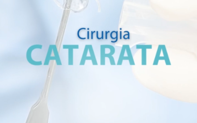 CIRURGIA CATARATA