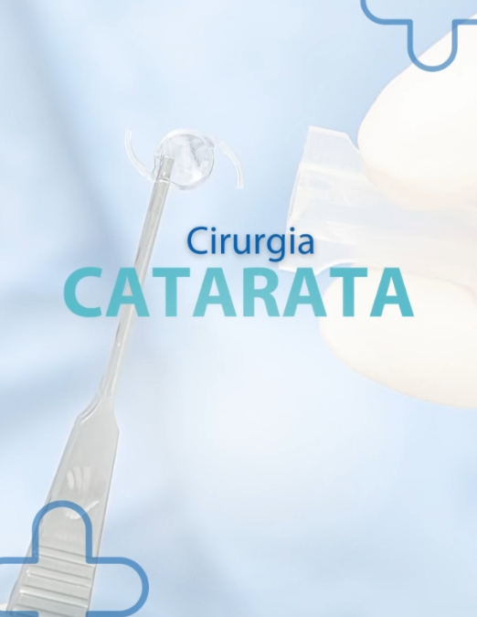 CIRURGIA CATARATA