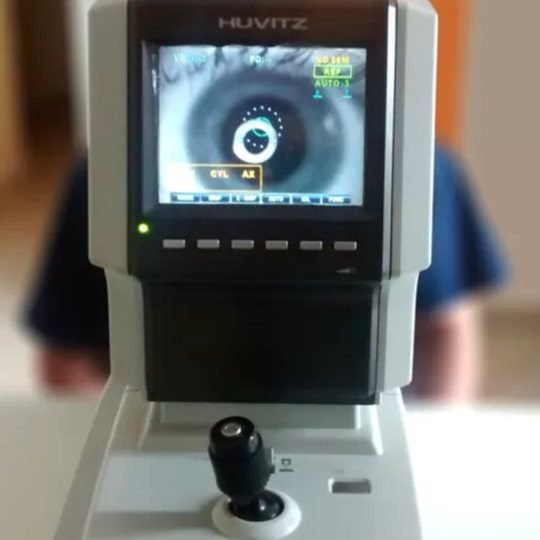 AUTO REFRATOR